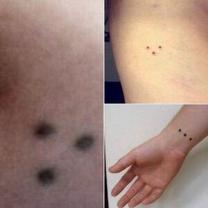 The ‘three-dot tattoo’ – potential meaning and significance